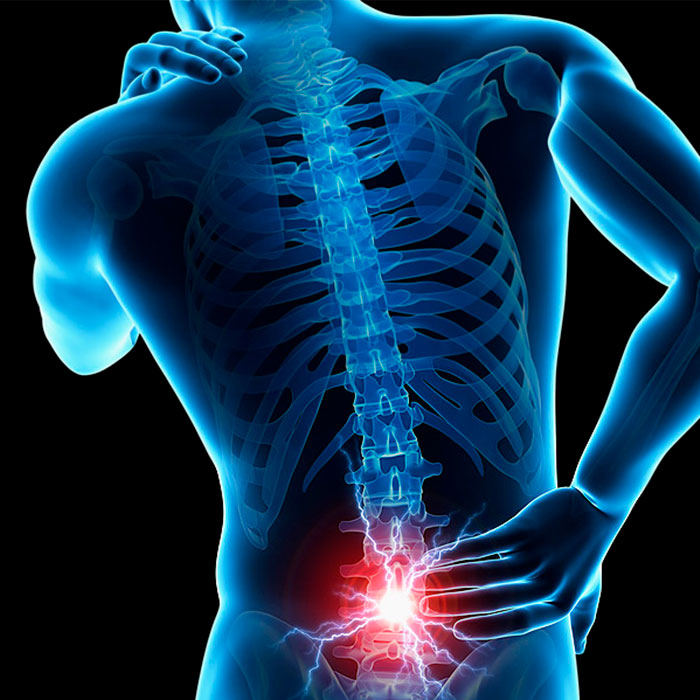 Hernia discal Quirovida